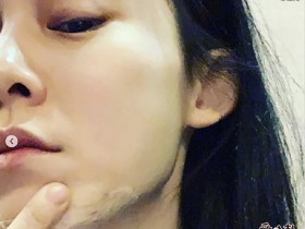 德州扑克在线APP:范玮琪发生了什么下巴缝15针?为何其那么遭网友嫌弃?【大发扑克】